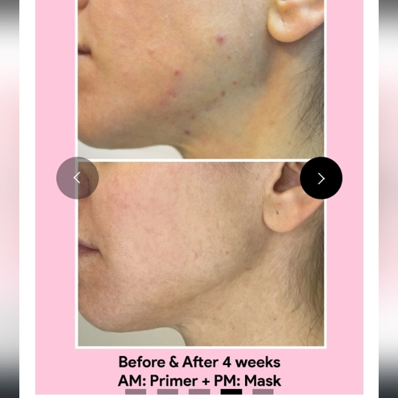 Jori Rx - Picture 3 of 5